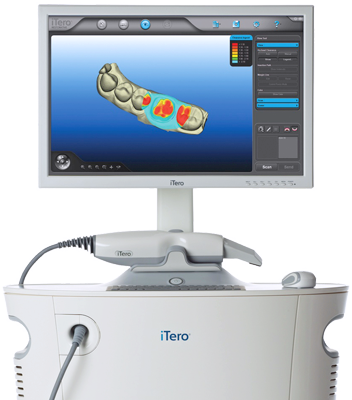 itero scanner