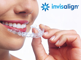 teaser c invisalign