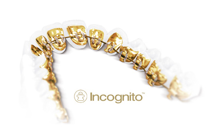 incognito-01